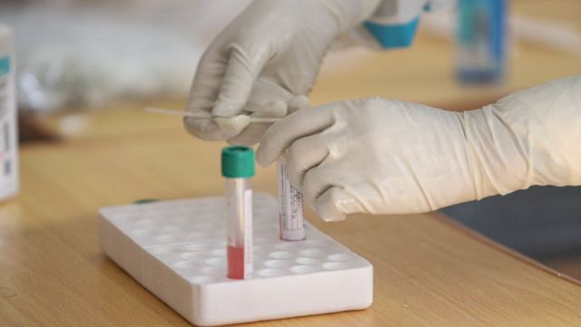 چینی محققین کا کہنا ہے کہ مقعد سواب زیادہ بہتر ٹیسٹ ہے