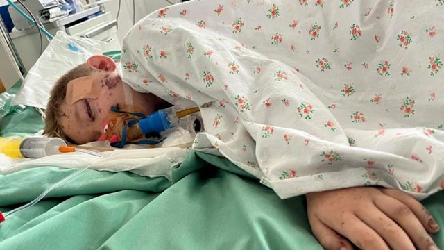 Dimitri in intensive care