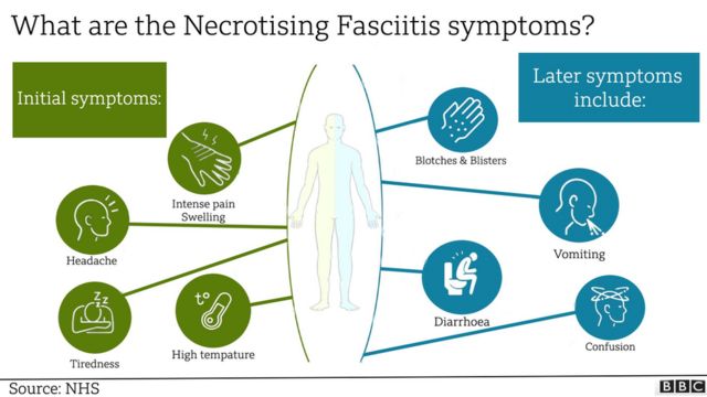 نیکروٹائزنف فسائیٹس